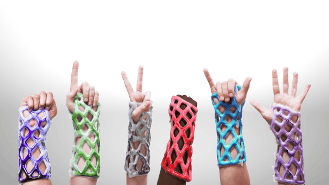 hands in casts